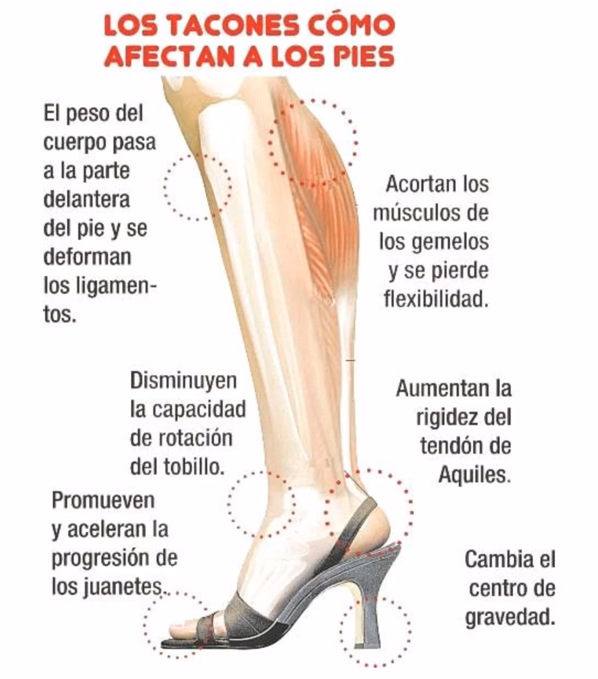 ¿Qué puede causar dolor en los pies al caminar?