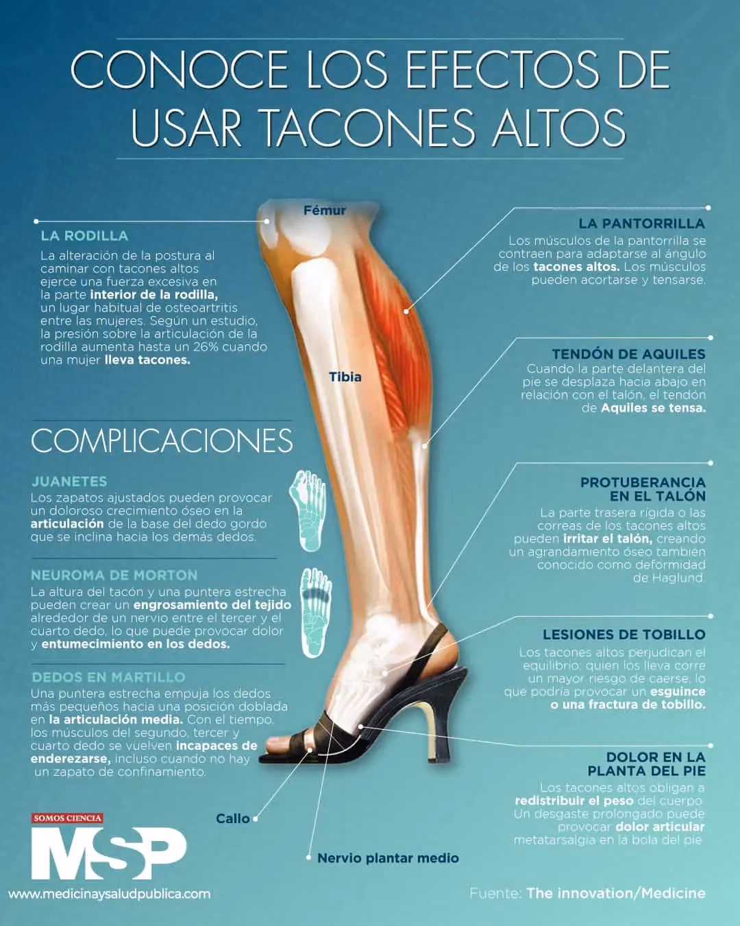 ¿Por qué se calzan zapatos con tacones?