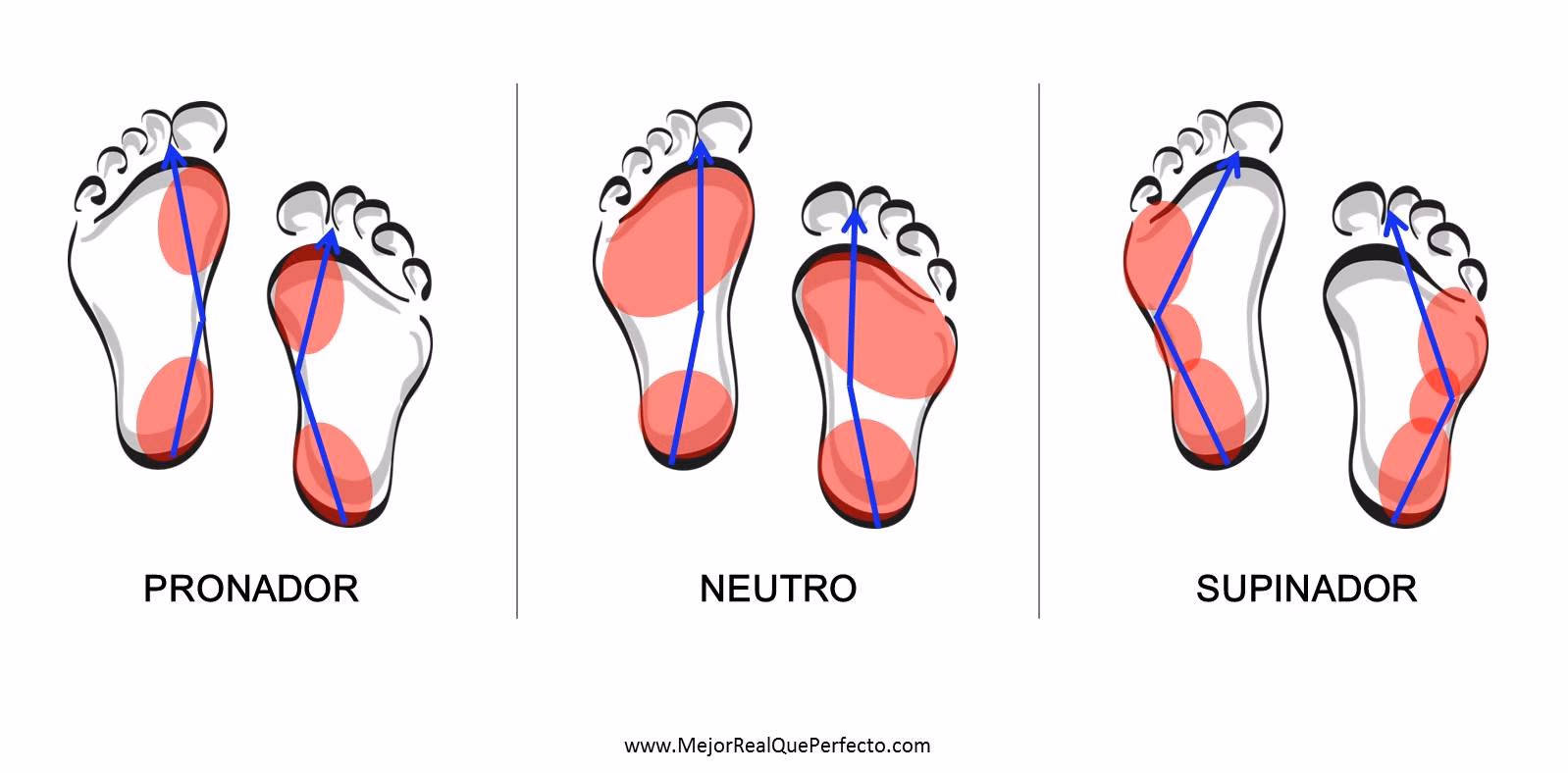 ¿Por qué me duelen los dedos con los zapatos grandes?