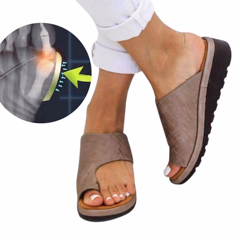 ¿Qué calzado usar después de una cirugía de juanetes?