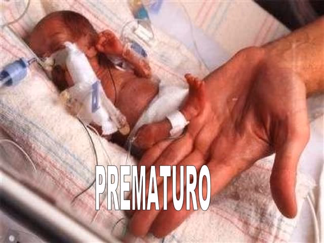 ¿Cómo tratar la ERGE en recién nacidos prematuros?