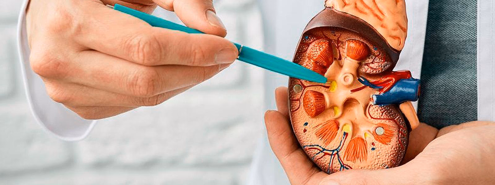 ¿Qué es el dolor de piedra en los riñones?