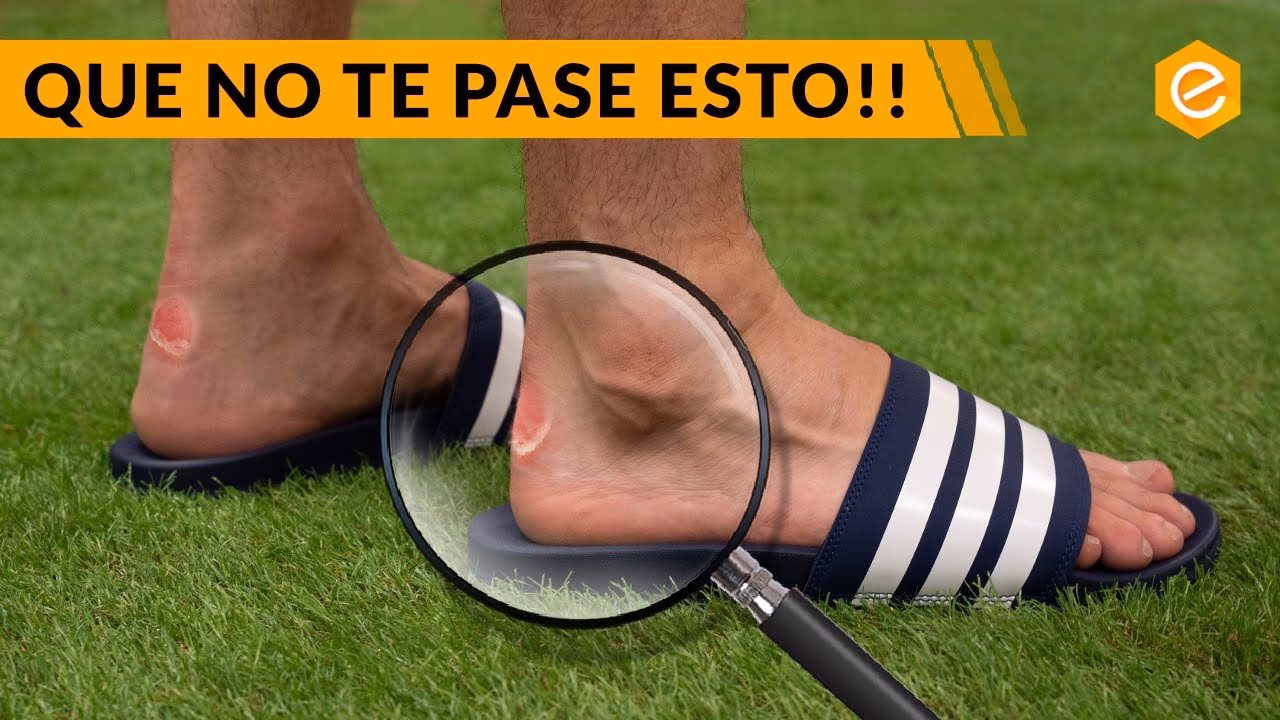 ¿Cómo evitar la fricción del tobillo?