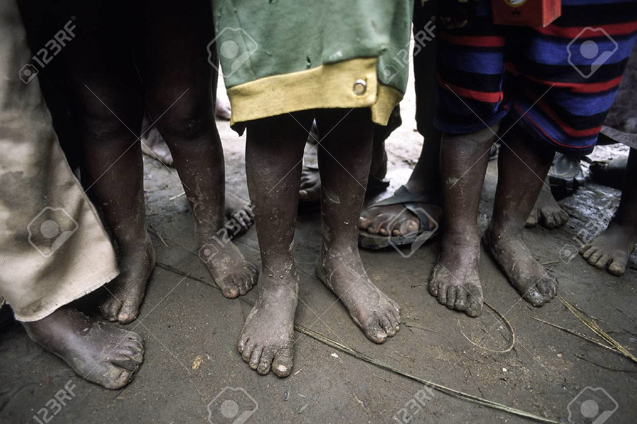 ¿Por qué Pierre no tenía zapatos?