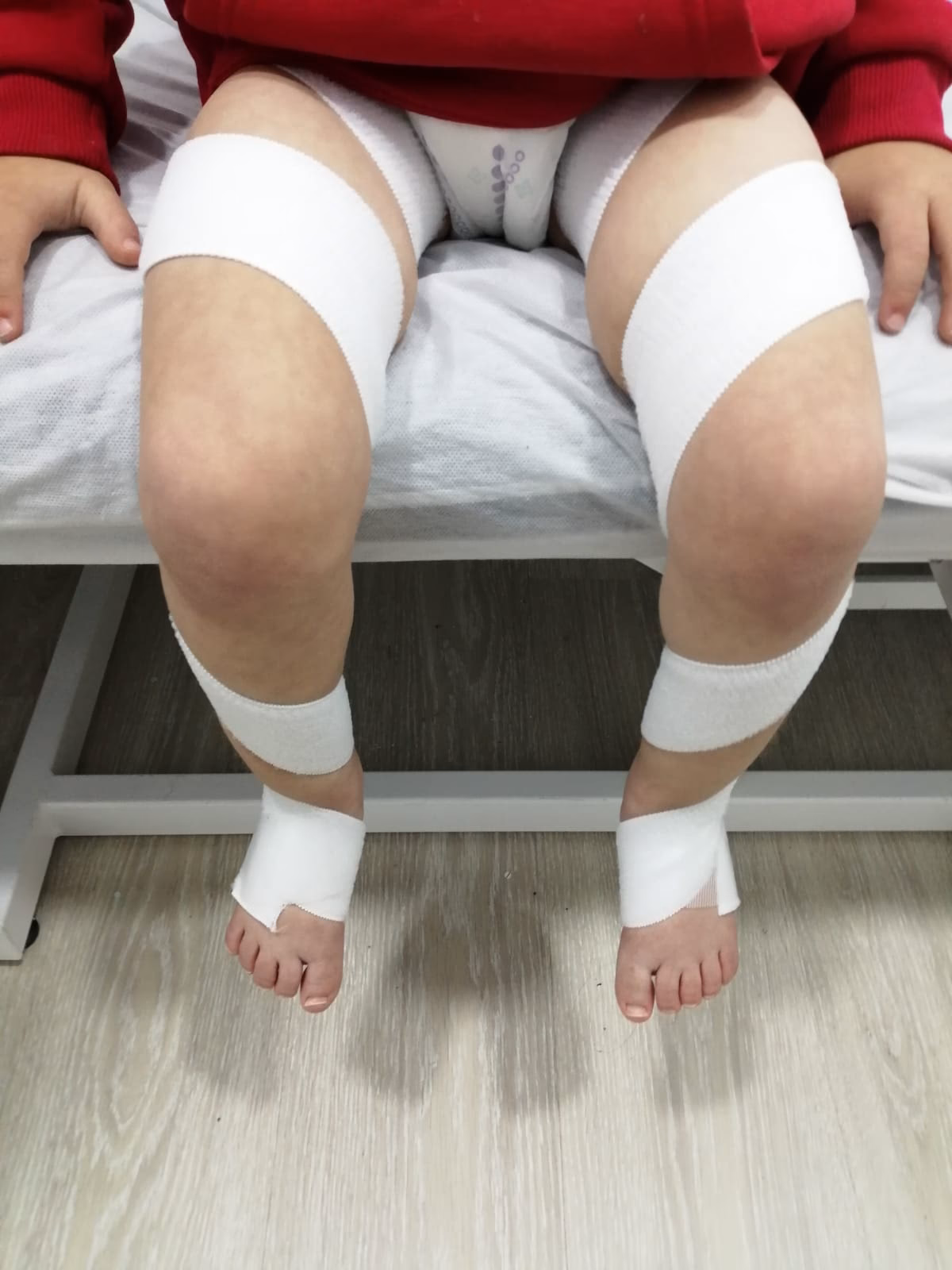 ¿Cómo escoger los mejores zapatos para la fisionomía del pie?