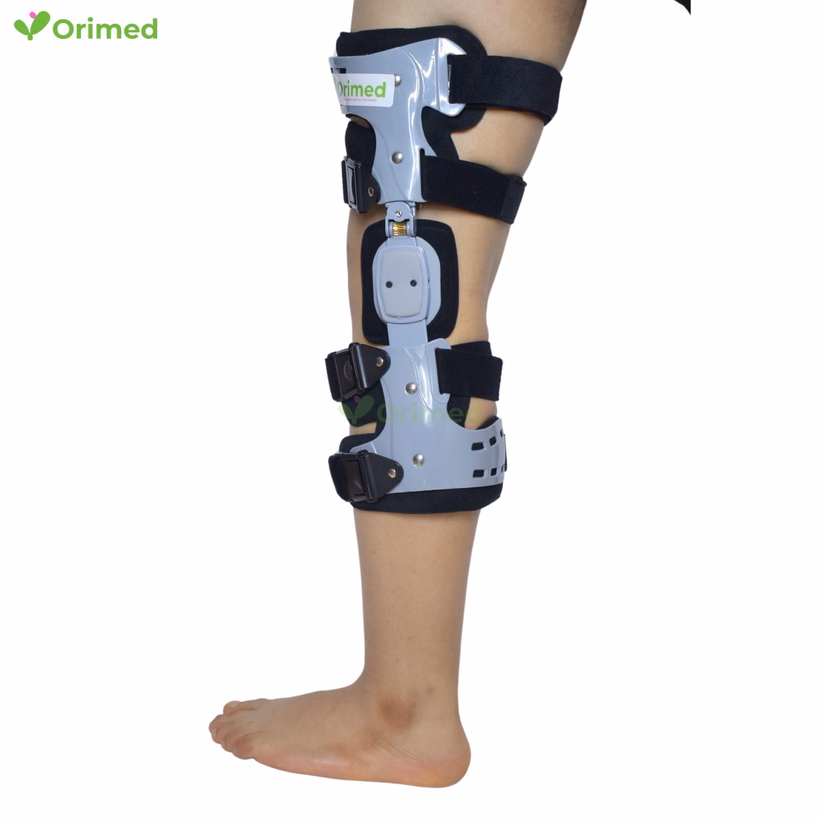 ¿Cómo tratar las piernas arqueadas en niños?